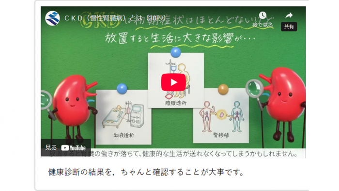 CKD30秒動画